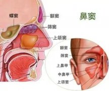 【全國(guó)愛(ài)鼻日】孩子出現(xiàn)這些癥狀，警惕鼻竇炎！ 